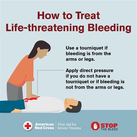 Stop The Bleed Its Time To Train