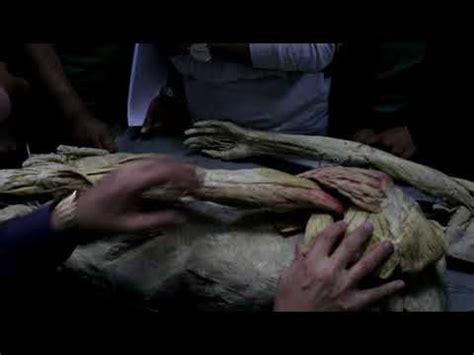 practical muscle of upper limb part2 - YouTube