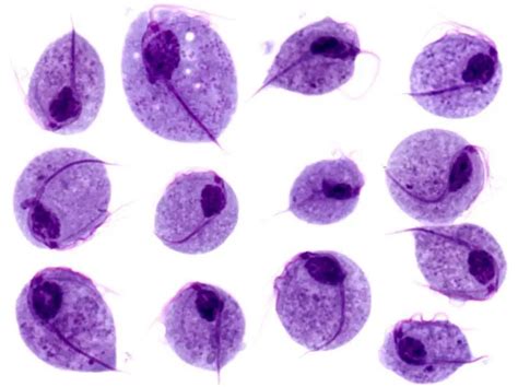 Lab Diagnosis Of Trichomonas Vaginalis Infections • Microbe Online