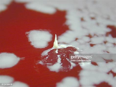 Sheep Blood Agar Photos And Premium High Res Pictures Getty Images