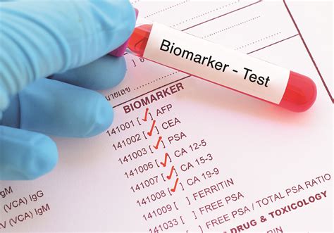 Biomarker Testing Changes Treatment Plans State Legislations Change