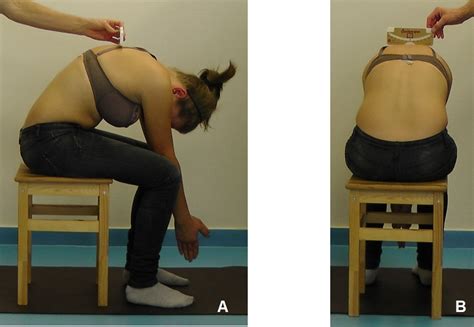 The patient bends forward, as if they are diving. School screening for scoliosis: can surface topography ...
