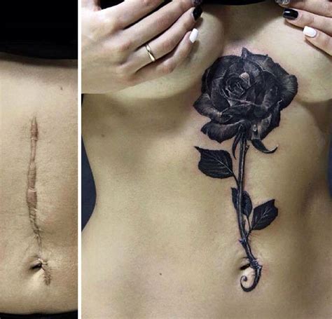 Incredible Scar Tattoo Cover Ups Inspirationfeed