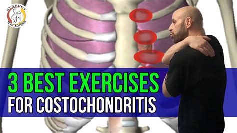 3 Best Exercises For Costochondritis Youtube