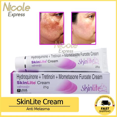 Skinlite Cream 25g Anti Melasma Pekas Remover Skin Lightening Dark