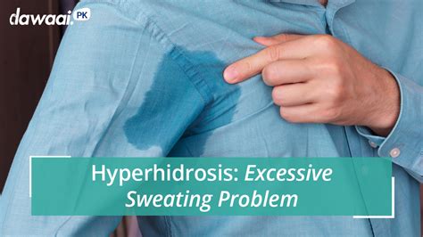Hyperhidrosis Treatment In Pakistan How To Cure Excessive Sweating