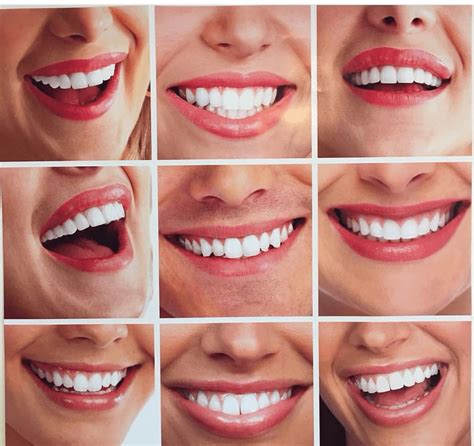 Restore Your Smile With Teeth Filing American Dental Clinic