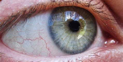 We did not find results for: My green/gray/blue eyes. : eyes