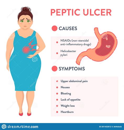 Causes And Symptoms Of Peptic Ulcer Stomach Disease Stock Illustration