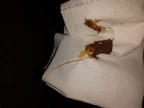 Get the newsletter join the list and never miss a thing. White "stringy thing" in stool On CureZone Image Gallery