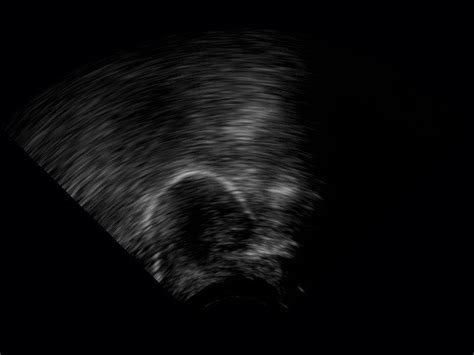 Sagittal Tongue Ultrasound Image At Vowel U Download Scientific