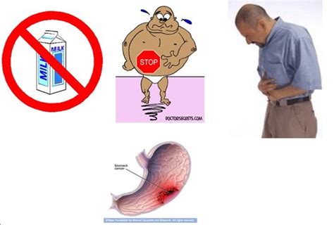 Digestive Diseases Science Department St Georges College