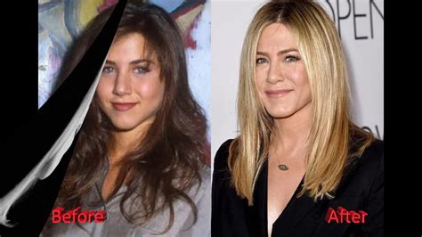 Jennifer Aniston Nose Job Plastic Surgery Before And After Youtube