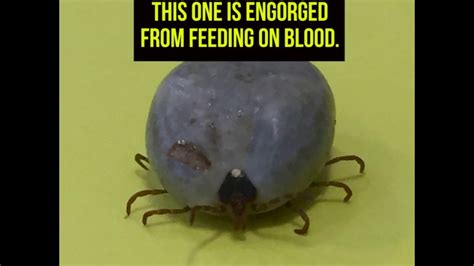 This Tick Could Make You Allergic To Meat Youtube