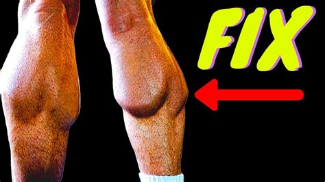 Tight Calves TRIGGER POINT RELEASE Three CALF QUICK FIX TIPS YouTube