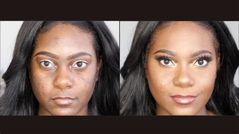 How To Cover Acne And Scars With Makeup Drugstore Version 2016 Youtube