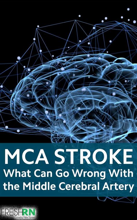 Mca Stroke What Can Go Wrong With The Middle Cerebral Artery Freshrn