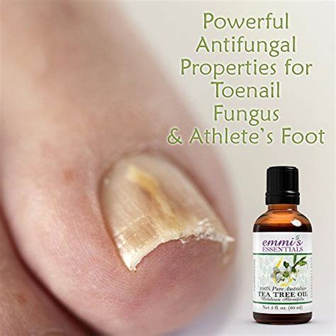 Treat Toenail Fungus And Athletes Foot With Tea Tree Oil