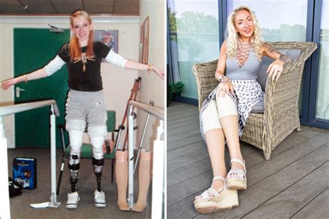 Amputee Mum Clare Brown Defies Odds To Become Model After Meningitis