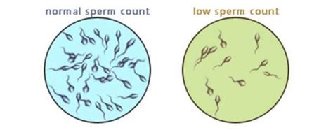 Low Sperm Count Here S What You Can Do Esha IVF