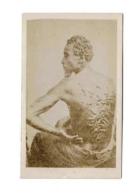 Gordon The Slave Who Escaped The Scourged Back Civil War Cdv Antique Price Guide Details Page