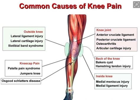 Kneepain Cawley Physical Therapy