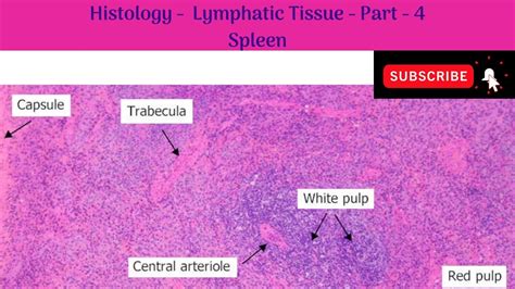 Histology Of Lymphatic Tissue Part 4 Spleen White And Red Pulp