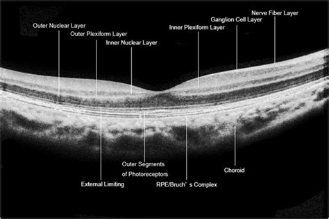 Retinal Layers Shown In An Oct Edi Pattern Scan Image Download