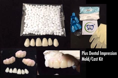 Do It Yourself Missing Tooth Kit Dental Impression Mold Etsy
