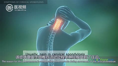 动画解析颈椎病：病因及症状 不良的姿势会加重身体的负担颈椎病新浪新闻