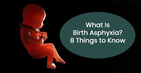 What Is Birth Asphyxia 8 Things To Know Sommers Roth And Elmaleh