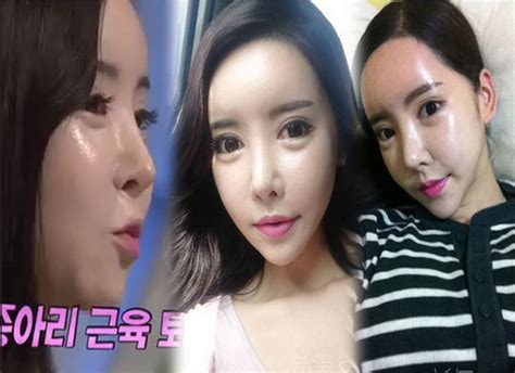 Girls Generation Plastic Surgery Is Finally Revealed Plastic Surgery Magazine