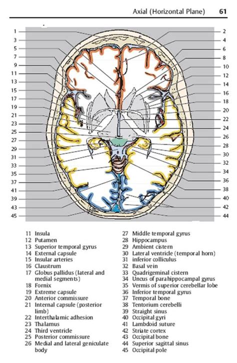 Axial View Of Brain Structures Including Commissura Neurociencia