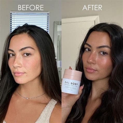 Bali Body Official On Instagram Before And After Achieve A Natural