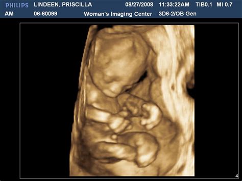 Its A Boy Ultrasound 20 Weeks Due Date Jan 16th Priscilla Flickr