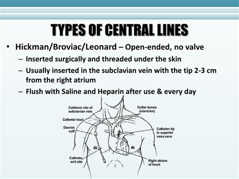 Ppt Central Lines Patient Safety Considerations Powerpoint