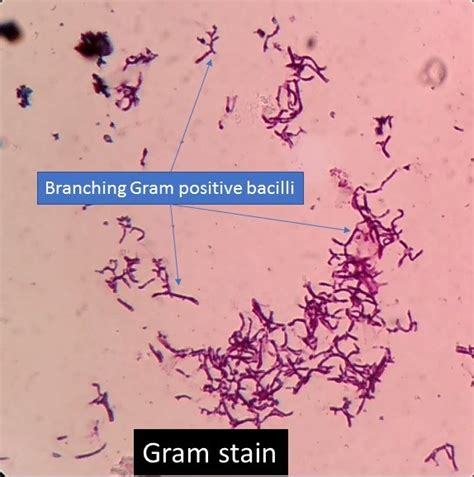 Branching Gram Positive Bacilli Introduction Principle Of Gram Stain