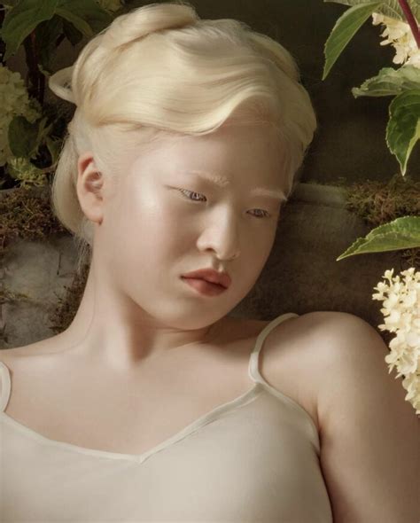 Albino Girl Gets Abandoned As A Baby Grows Up To Become A Vogue Model Pics Delaram Art