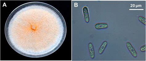 Isolation And Identification Of The Fungus Colletotrichum Cordylinicola