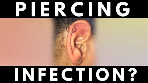 Piercing Infections Or Irritation How Do I Know I Have One Youtube