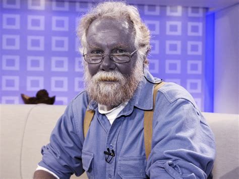 The Intriguing History Of The People With Blue Skin History Of Yesterday