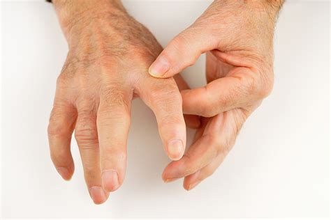 what should i do if i think i broke my finger countryside orthopaedics