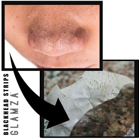 Nose Strips Blackhead Removal Unclog Pores Smooth Peel Off Deep