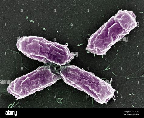 La Bacteria Salmonella Color Análisis Micrografía De Electrones Sem