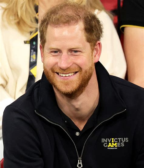 Prince Harry Jokes About Going Bald Saying Hes Doomed