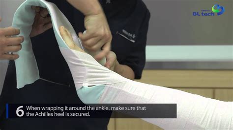 Application Video Long Leg Splint Youtube