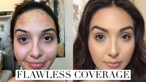 How To Cover Acne Breakouts And Dark Spots With Makeup Youtube