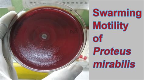 Swarming Of Proteus Mirabilis On Blood Agar Youtube