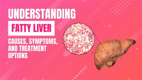 Understand Fatty Liver Causes Symptoms And Treatments Walk In Lab