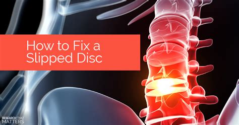 Because of how close the discs are to the nerves that we talked about if this isn't fixed soon, you might end up with a permanent problem. How to Fix a Slipped Disc - Huntsville, Madison, Alabama ...